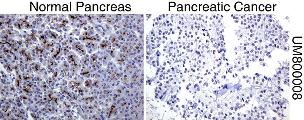 EMA / MUC1 Antibody (clone UMAB57, Carrier-free)