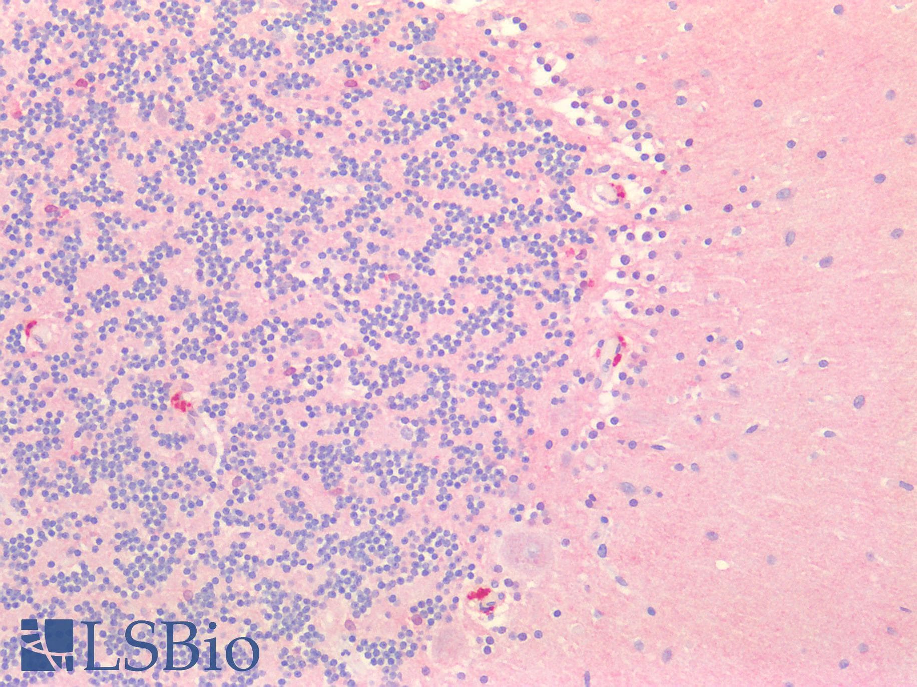 BACE2 Antibody (aa242-502)