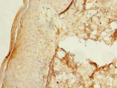 UBXN6 / UBXD1 Antibody