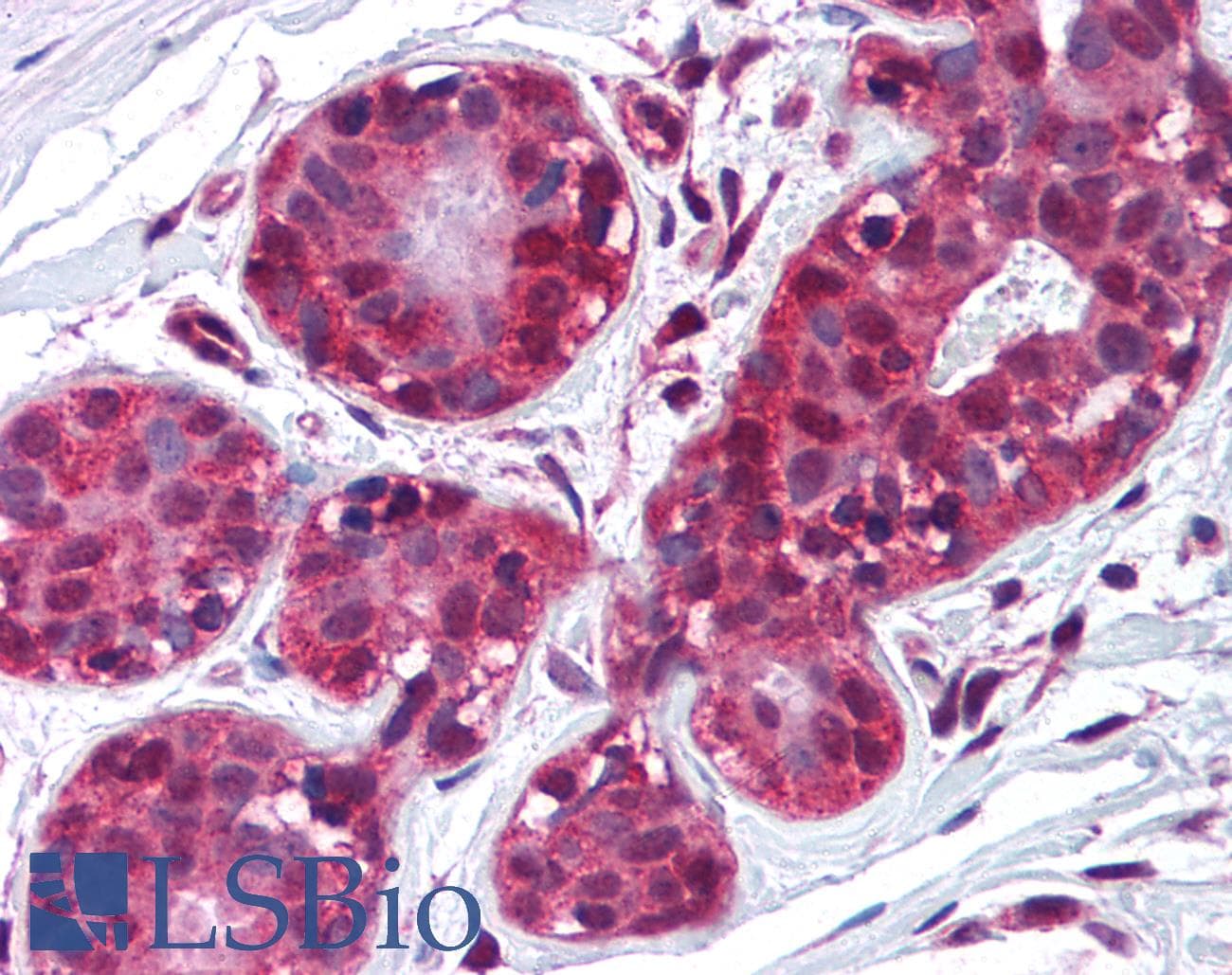 PathPlus™ TIMP2 Antibody (clone F27P3A4)