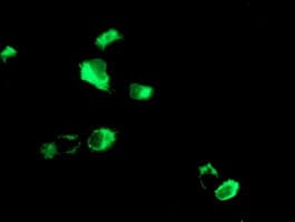 MAC-2-BP / LGALS3BP Antibody (clone OTI1F8)
