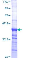 Human LAMA2 / Merosin Protein (Recombinant GST, N-terminus)