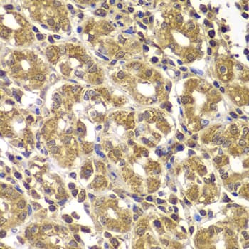 Polyclonal Rabbit anti-Human HSPE1 / HSP10 / Chaperonin 10 Antibody (IHC, IF, WB)