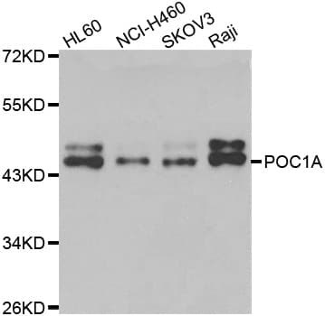 Polyclonal Rabbit anti-Human POC1A / SOFT Antibody (IHC, IF, WB)