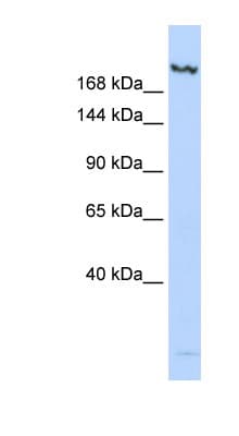 Polyclonal Rabbit anti-Human KDM6B / JMJD3 Antibody (N-Terminus, WB)