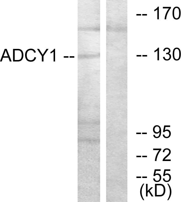 IHC-plus™ Polyclonal Rabbit anti-Human ADCY1 / Adenylate Cyclase 1 Antibody (aa231-280, IHC, WB)