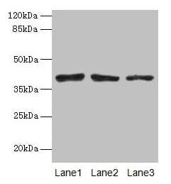 ATP6AP2 / Renin Receptor Antibody (aa1-176)