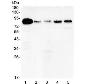 Polyclonal Rabbit anti-Human CTTN / Cortactin Antibody (IHC, IF, WB)