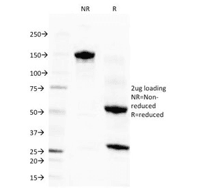 Eosinophil Peroxidase / EPX Antibody (clone EPO104)