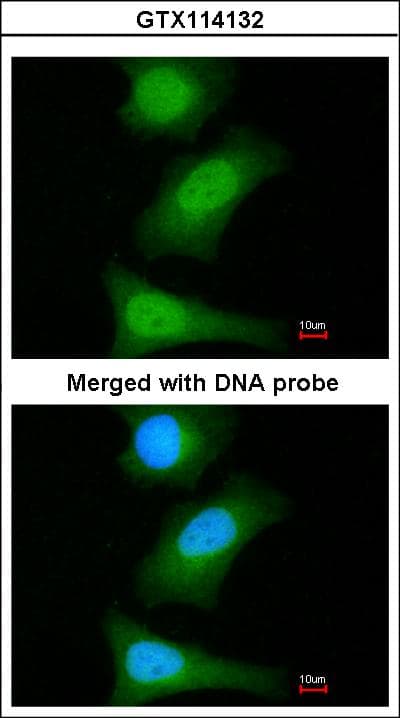 BIRC7 / Livin Antibody (aa1-241)