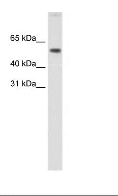 AKT1 Antibody (aa121-170)