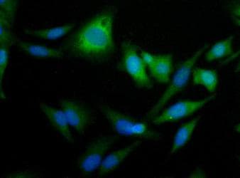 PLIN2 / ADFP / Adipophilin Antibody (aa350-425)