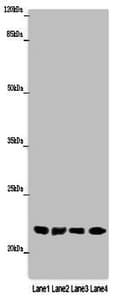 Polyclonal Rabbit anti-Human ABHD14B Antibody (aa2-210)