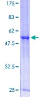 Human RPP30 Protein (Recombinant GST)
