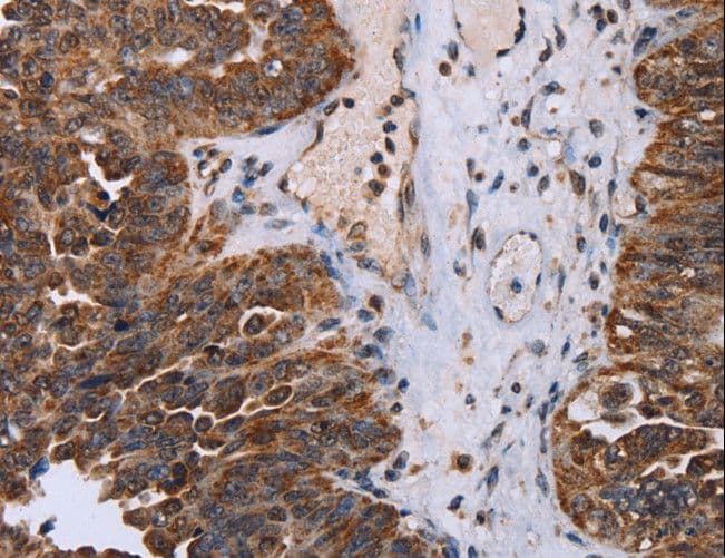 DDX11 / CHLR1 Antibody