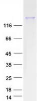 Human FYCO1 Protein (Recombinant Myc-DDK (Flag))