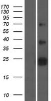 ZNRF2 Protein (Over-Expression Lysate Myc-DDK (Flag))