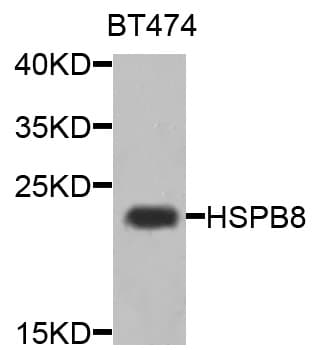 Polyclonal Rabbit anti-Human HSPB8 / H11 / HSP22 Antibody (IHC, IF, WB)