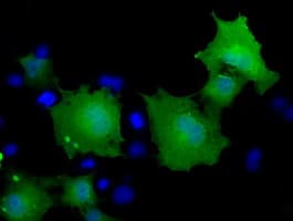 MOBKL2B / MOB3B Antibody (clone OTI1A3, Carrier-free)
