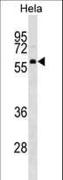 NELFCD / TH1L / TH1 Antibody (aa548-576)