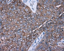 PRKAR2A Antibody (clone OTI1B4)