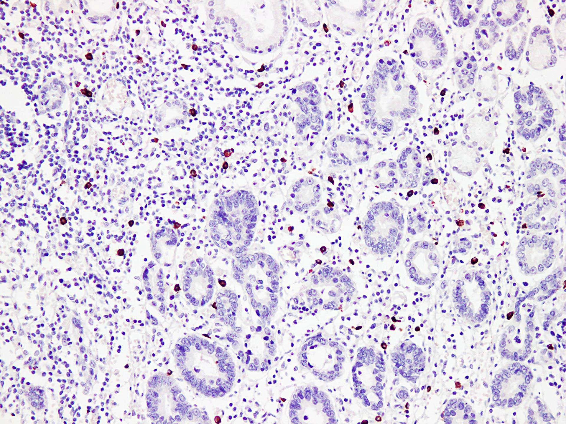 PathPlus™ Monoclonal Mouse anti-Human TPSAB1 / Mast Cell Tryptase Antibody (clone ABT-MCT, IHC)
