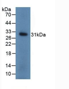UCHL1 / PGP9.5 Antibody (aa2-223)