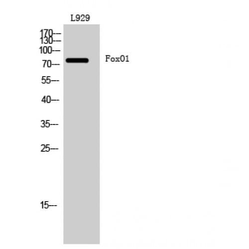 Polyclonal Rabbit anti-Human FOXO1 / FKHR Antibody (190-270 aa, IHC, IF, WB)