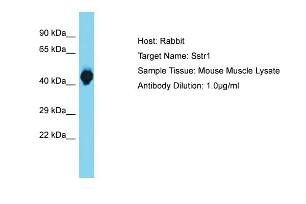 SSTR1 Antibody (C-Terminus)