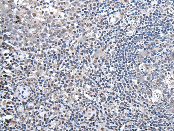 ZBTB10 Antibody