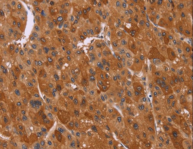 CTNNBL1 / NAP Antibody