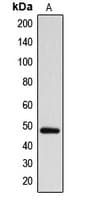 ARRDC1 Antibody (Internal)