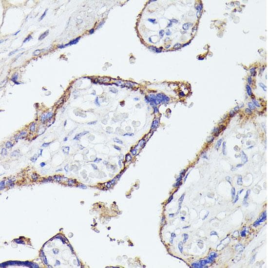 LF / LTF / Lactoferrin Antibody