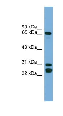CILD9 / DNAI2 Antibody (aa71-120)