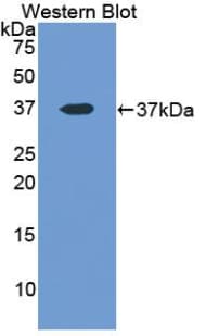 LDHA / LDH1 Antibody (aa1-332)