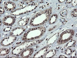 MME / CD10 Antibody (clone OTI3D11)