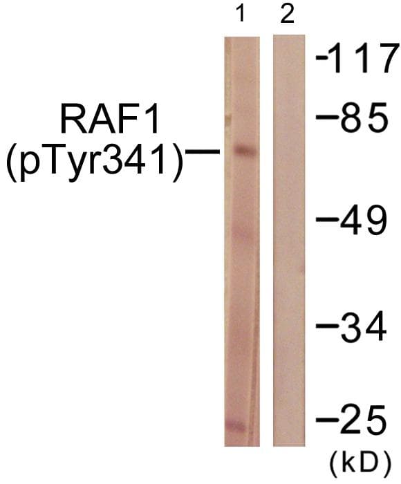 RAF1 / RAF Antibody (phospho-Tyr341)
