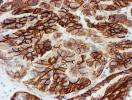 Monoclonal Mouse anti-Human FXYD3 Antibody (clone OTI1E8, IHC, IF, WB)