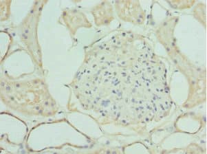 IHC-plus™ Polyclonal Rabbit anti-Human LIMS1 / PINCH Antibody (IHC, IF, WB)