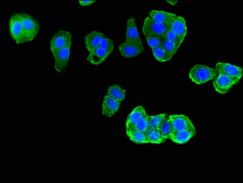 PIM3 / PIM-3 Antibody