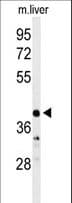 Polyclonal Rabbit anti-Human CA-VB / CA5B Antibody (aa253-283, IHC, WB)