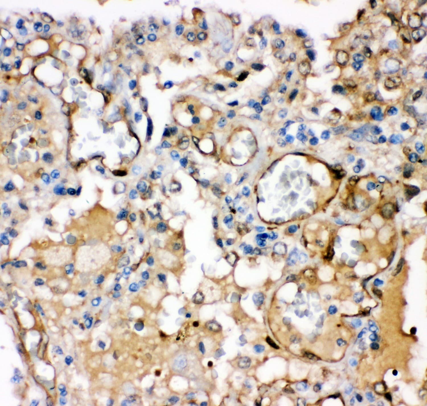 KCNMA1 / BK Antibody (aa124-467)