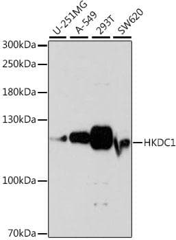 Polyclonal Rabbit anti-Human HKDC1 Antibody (WB)