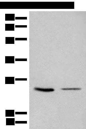 CDCA4 Antibody