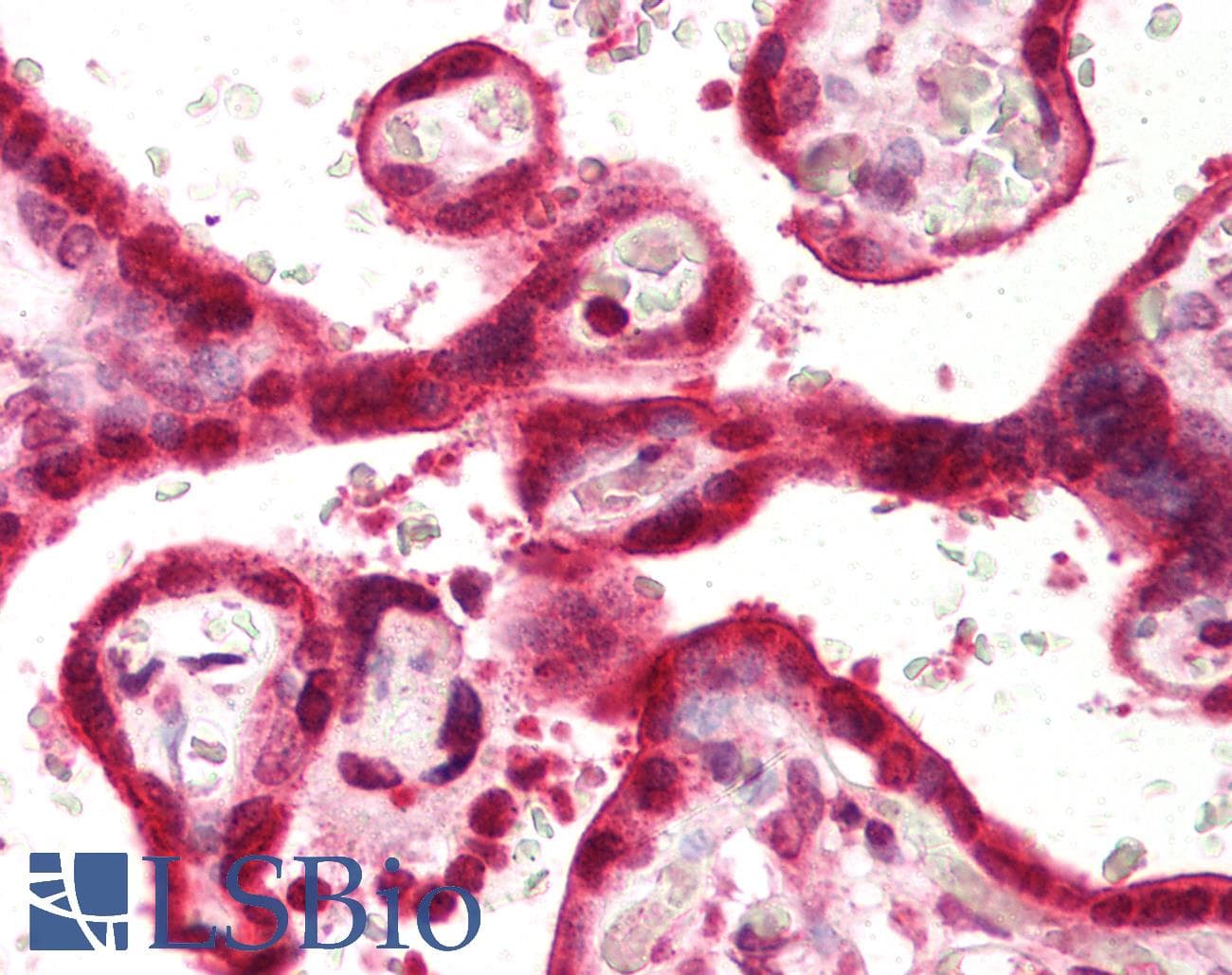 IHC-plus™ Monoclonal Mouse anti-Human SLC9A3R1 / NHERF1 / EBP50 Antibody (clone EBP-10, IHC, WB)