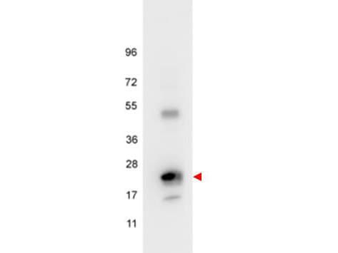 IL6 / Interleukin 6 Antibody