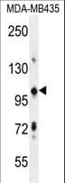 Polyclonal Rabbit anti-Human TRIM33 / TIF1-Gamma Antibody (aa1095-1125, WB)