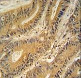 Polyclonal Rabbit anti-Human GNAT3 / Gustducin Antibody (aa78-105, IHC, WB)