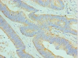 DCAF7 / WDR68 Antibody (aa1-342)