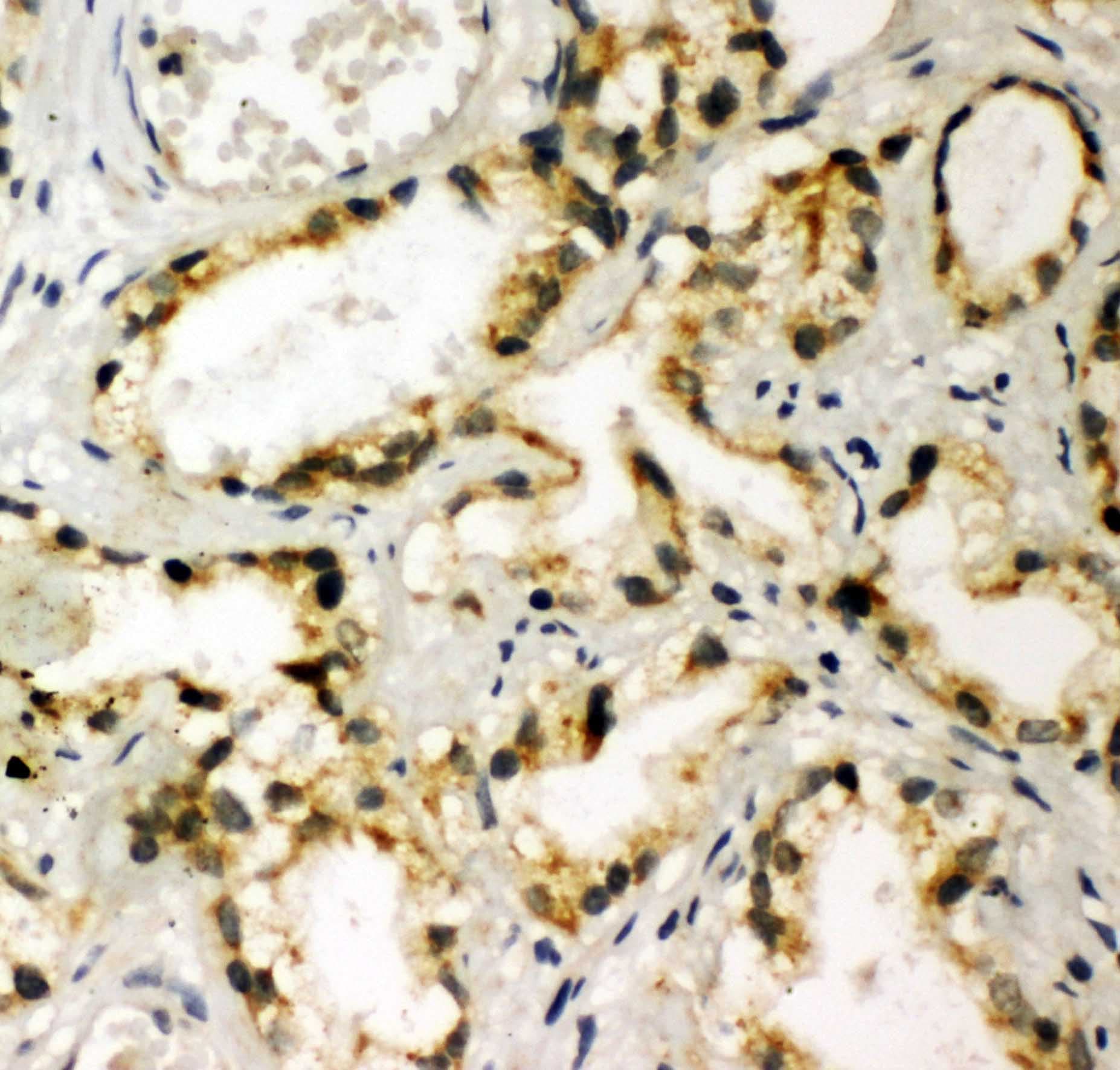 NAK / TBK1 Antibody (aa577-590)